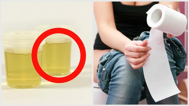Die Behandlung onichodistrofii der Nägel auf den Händen